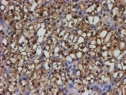 PSMB9 Monoclonal Antibody (OTI2G6), TrueMAB , OriGene 100 &mu;L; Unconjugated:Antibodies,