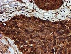 PSMB9 Monoclonal Antibody (OTI2B6), TrueMAB , OriGene 100 &mu;L; Unconjugated:Antibodies,