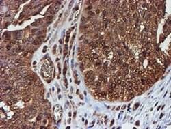 PSMB9 Monoclonal Antibody (OTI2B6), TrueMAB , OriGene 100 &mu;L; Unconjugated:Antibodies,
