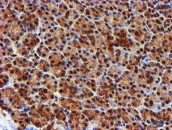 PSMB9 Monoclonal Antibody (OTI2B6), TrueMAB , OriGene 100 &mu;L; Unconjugated:Antibodies,