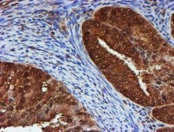 PSMB9 Monoclonal Antibody (OTI2B6), TrueMAB , OriGene 100 &mu;L; Unconjugated:Antibodies,