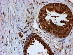 PSMB9 Monoclonal Antibody (OTI2B6), TrueMAB , OriGene:Antibodies:Primary