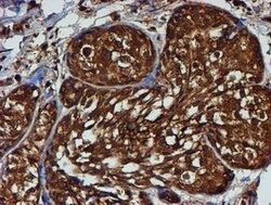 PSMB9 Mouse anti-Canine, Human, Mouse, Rat, Clone: OTI2B6, lyophilized,