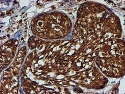 PSMB9 Monoclonal Antibody (OTI2B6), TrueMAB , OriGene 100 &mu;L; Unconjugated:Antibodies,