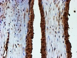 PSMB9 Monoclonal Antibody (OTI2B6), TrueMAB , OriGene 100 &mu;L; Unconjugated:Antibodies,