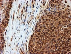 PSMB9 Mouse anti-Canine, Human, Mouse, Rat, Clone: OTI2B6, lyophilized,