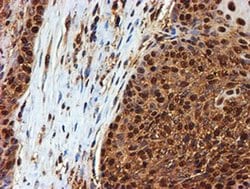 PSMB9 Monoclonal Antibody (OTI2B6), TrueMAB , OriGene 100 &mu;L; Unconjugated:Antibodies,