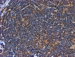 PSMB9 Monoclonal Antibody (OTI2B6), TrueMAB , OriGene:Antibodies:Primary