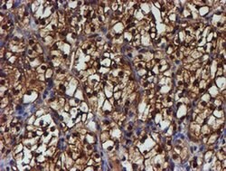 PSMB9 Monoclonal Antibody (OTI2B6), TrueMAB , OriGene 100 &mu;L; Unconjugated:Antibodies,