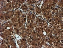 PSMB9 Monoclonal Antibody (OTI2B6), TrueMAB , OriGene 100 &mu;L; Unconjugated:Antibodies,