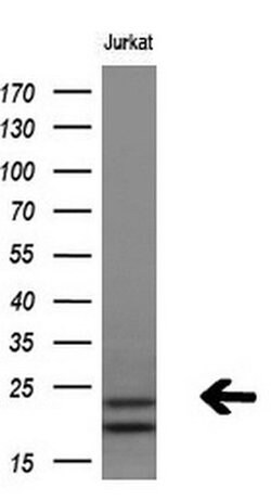 PSMB9 Monoclonal Antibody (OTI1D1), TrueMAB , OriGene 30 &mu;L; Unconjugated:Antibodies,