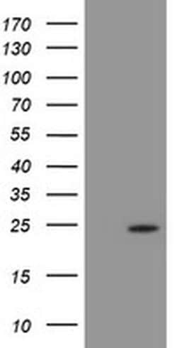 PSMB9 Monoclonal Antibody (OTI3H1), TrueMAB , OriGene 30 &mu;L; Unconjugated:Antibodies,