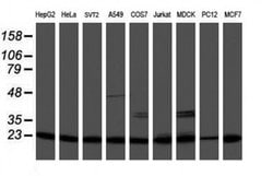 PSMB9 Monoclonal Antibody (OTI3F3), TrueMAB , OriGene 100 &mu;L; Unconjugated:Antibodies,