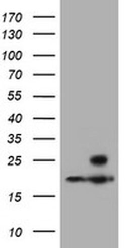PSMB9 Monoclonal Antibody (OTI2G6), TrueMAB , OriGene 100 &mu;L; Unconjugated:Antibodies,