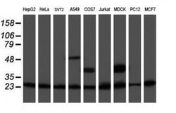 PSMB9 Monoclonal Antibody (OTI2G6), TrueMAB , OriGene 100 &mu;L; Unconjugated:Antibodies,