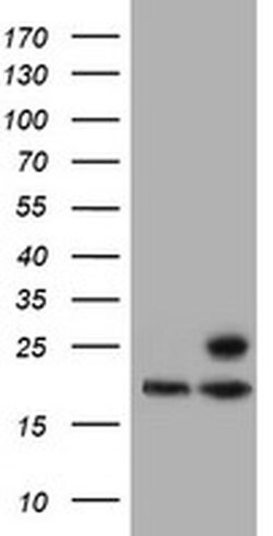 PSMB9 Monoclonal Antibody (OTI2B6), TrueMAB , OriGene 100 &mu;L; Unconjugated:Antibodies,