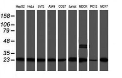 PSMB9 Monoclonal Antibody (OTI2B6), TrueMAB , OriGene 100 &mu;L; Unconjugated:Antibodies,