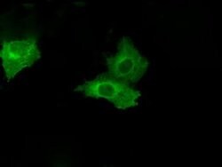PSMC3 Monoclonal Antibody (OTI9F3), TrueMAB , OriGene 100 &mu;L; Unconjugated:Antibodies,