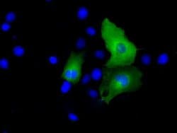 PSMC3 Monoclonal Antibody (OTI8G10), TrueMAB , OriGene 100 &mu;L; Unconjugated:Antibodies,