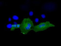 PSMC3 Monoclonal Antibody (OTI1C10), TrueMAB , OriGene 100 &mu;L; Unconjugated:Antibodies,