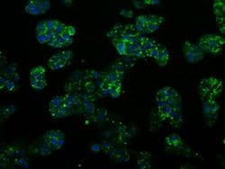 PSMC3 Monoclonal Antibody (OTI1C10), TrueMAB , OriGene 100 &mu;L; Unconjugated:Antibodies,
