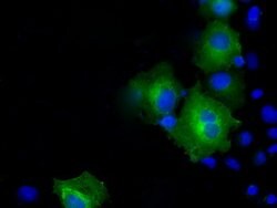 PSMC3 Mouse anti-Human, Clone: OTI9G5, lyophilized, TrueMAB 100 &mu;g;
