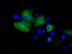 PSMC3 Mouse anti-Human, Clone: OTI10D12, lyophilized, TrueMAB 100 &mu;g;
