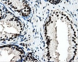 PSMC3 Monoclonal Antibody (OTI9F3), TrueMAB , OriGene 100 &mu;L; Unconjugated:Antibodies,