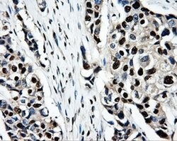PSMC3 Monoclonal Antibody (OTI9F3), TrueMAB , OriGene 100 &mu;L; Unconjugated:Antibodies,