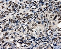 PSMC3 Monoclonal Antibody (OTI9F3), TrueMAB , OriGene 100 &mu;L; Unconjugated:Antibodies,