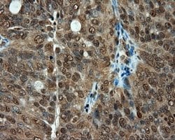 PSMC3 Mouse anti-Canine, Human, Rat, Clone: OTI1C10, lyophilized, TrueMAB