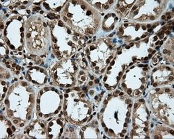 PSMC3 Mouse anti-Canine, Human, Rat, Clone: OTI1C10, lyophilized, TrueMAB