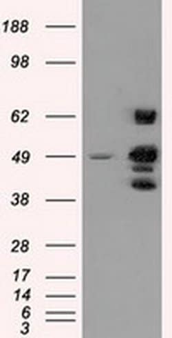 PSMC3 Monoclonal Antibody (OTI9F3), TrueMAB , OriGene 100 &mu;L; Unconjugated:Antibodies,