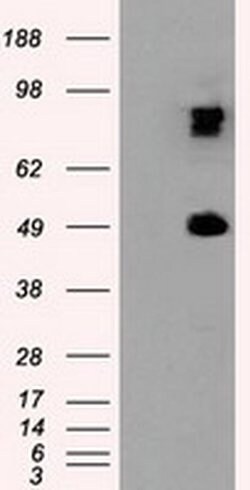 PSMC3 Monoclonal Antibody (OTI8G10), TrueMAB , OriGene:Antibodies:Primary