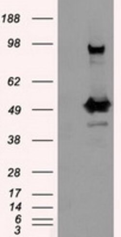 PSMC3 Mouse anti-Canine, Human, Rat, Clone: OTI1C10, lyophilized, TrueMAB