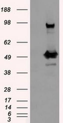 PSMC3 Monoclonal Antibody (OTI1C10), TrueMAB , OriGene 100 &mu;L; Unconjugated:Antibodies,