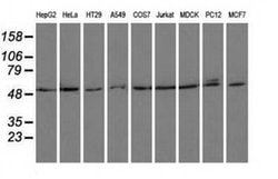 PSMC3 Monoclonal Antibody (OTI1C10), TrueMAB , OriGene 100 &mu;L; Unconjugated:Antibodies,
