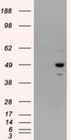 PSMC3 Mouse anti-Human, Clone: OTI9G5, lyophilized, TrueMAB 100 &mu;g;