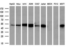 PSMC3 Monoclonal Antibody (OTI9G5), TrueMAB , OriGene 30 &mu;L; Unconjugated:Antibodies,