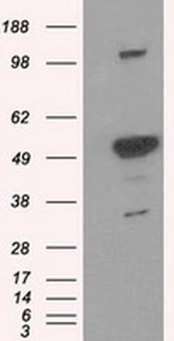 PSMC3 Monoclonal Antibody (OTI9C11), TrueMAB , OriGene:Antibodies:Primary