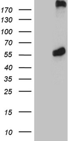 PSMC3 Monoclonal Antibody (OTI8D2), TrueMAB , OriGene 100 &mu;L; Unconjugated:Antibodies,