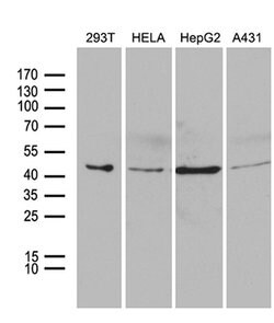 PSMC3 Monoclonal Antibody (OTI8D2), TrueMAB , OriGene 100 &mu;L; Unconjugated:Antibodies,