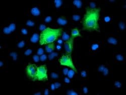 PSMD2 Mouse anti-Canine, Human, Clone: OTI1G5, lyophilized, TrueMAB 100