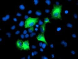 PSMD2 Monoclonal Antibody (OTI1G5), TrueMAB , OriGene 100 &mu;L; Unconjugated:Antibodies,