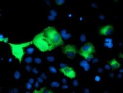 PSMD2 Monoclonal Antibody (OTI1A12), TrueMAB , OriGene 100 &mu;L; Unconjugated:Antibodies,
