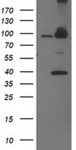 PSMD2 Monoclonal Antibody (OTI1G5), TrueMAB , OriGene 100 &mu;L; Unconjugated:Antibodies,