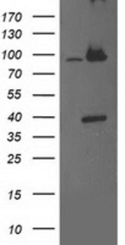PSMD2 Mouse anti-Human, Clone: OTI1A12, lyophilized, TrueMAB 100 &mu;g;