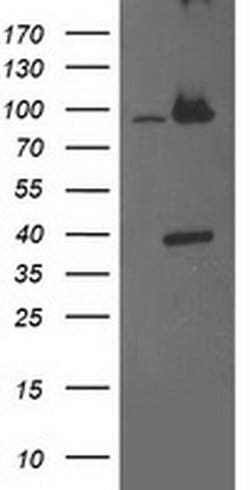 PSMD2 Monoclonal Antibody (OTI1A12), TrueMAB , OriGene:Antibodies:Primary