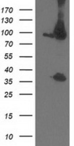 PSMD2 Mouse anti-Human, Clone: OTI1B4, lyophilized, TrueMAB 100 &mu;g;