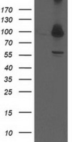 PSMD2 Mouse anti-Human, Clone: OTI1D1, lyophilized, TrueMAB 100 &mu;g;